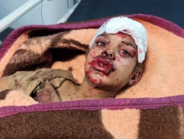 مجروح شدن چهار نوجوان براثر انفجار مین در شهر مهران