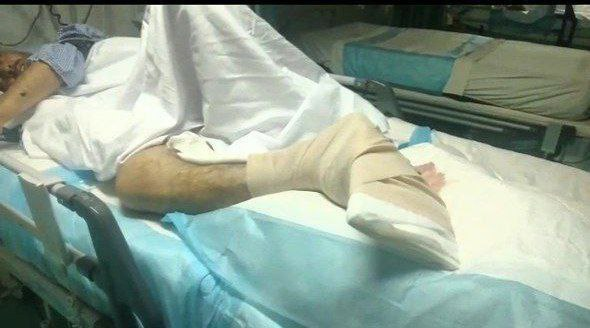 زخمی شدن یک کولبر اهل سقز در اثر انفجار مین و عدم توانایی پرداخت پول برای عمل جراحی